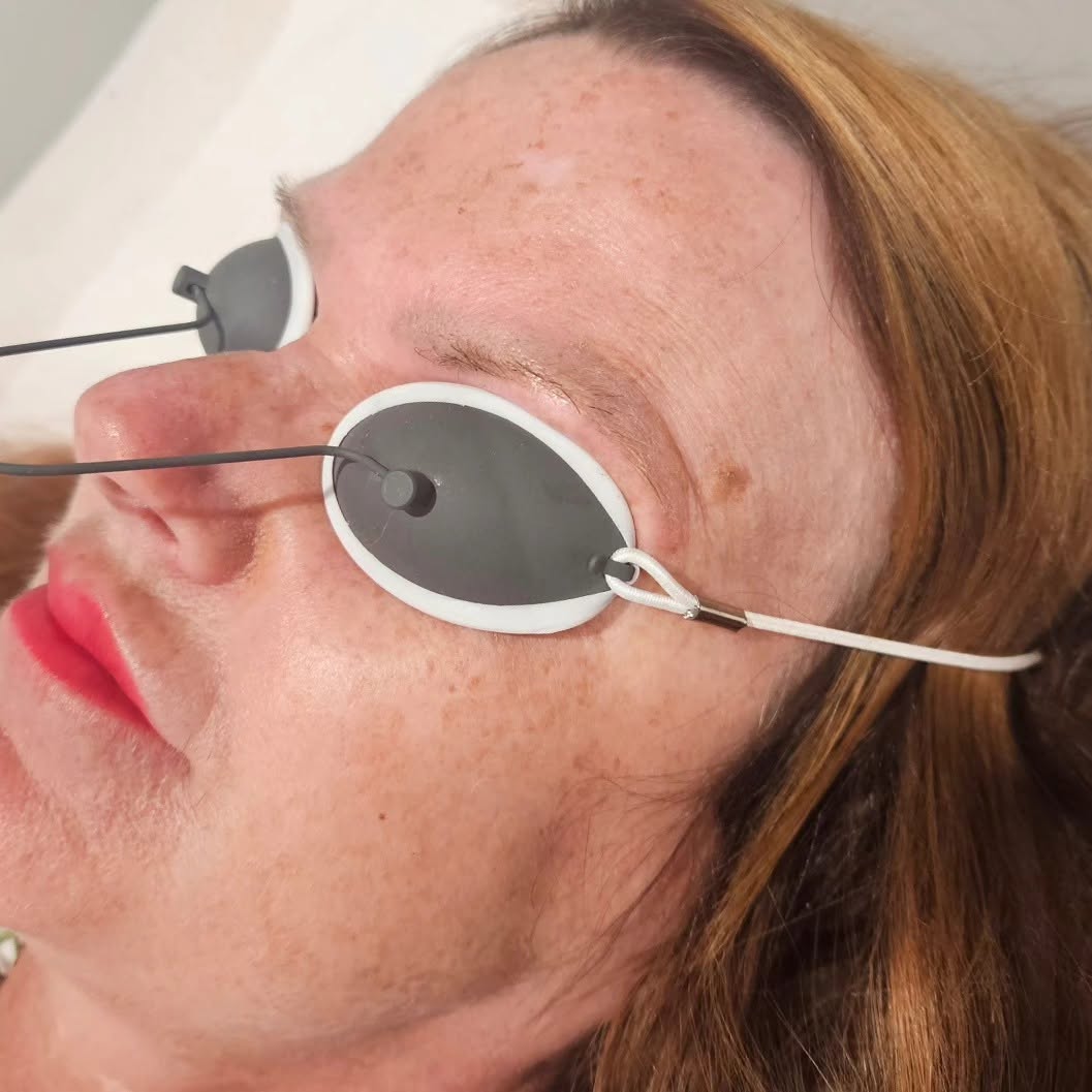 Tattoo Removal in Cardigan, Ceredigion at Serenity Beauty Salon